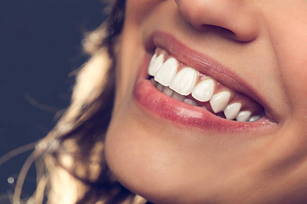 Smile transformation